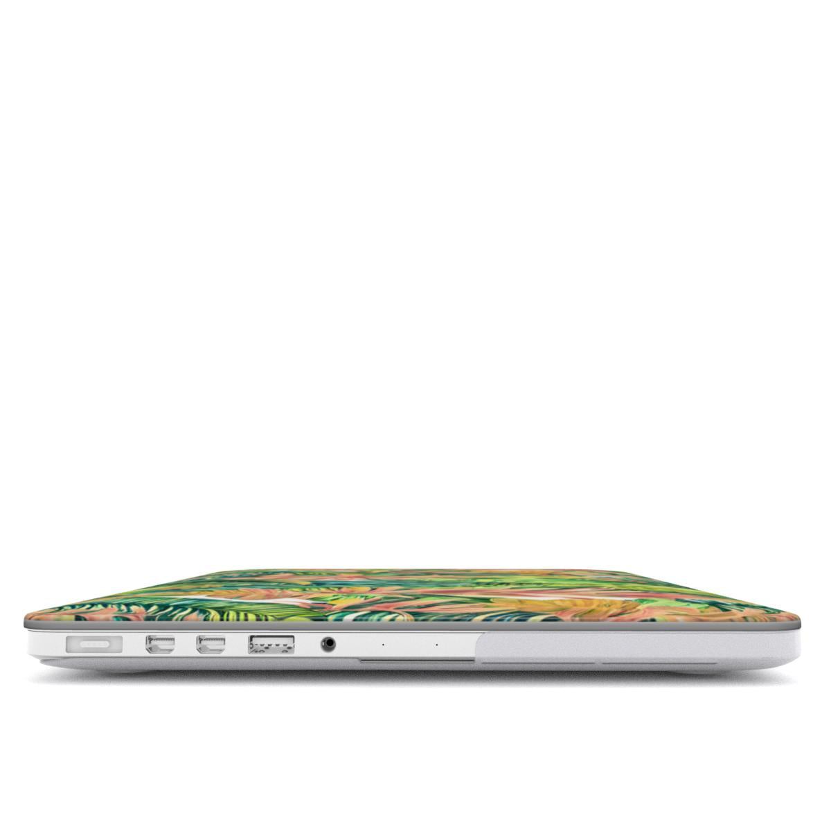 Hawaiian Tropical Leaves MacBook Case - The Global Wanderer